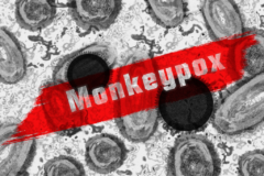 No Confirmed Cases of Monkeypox in Grenada